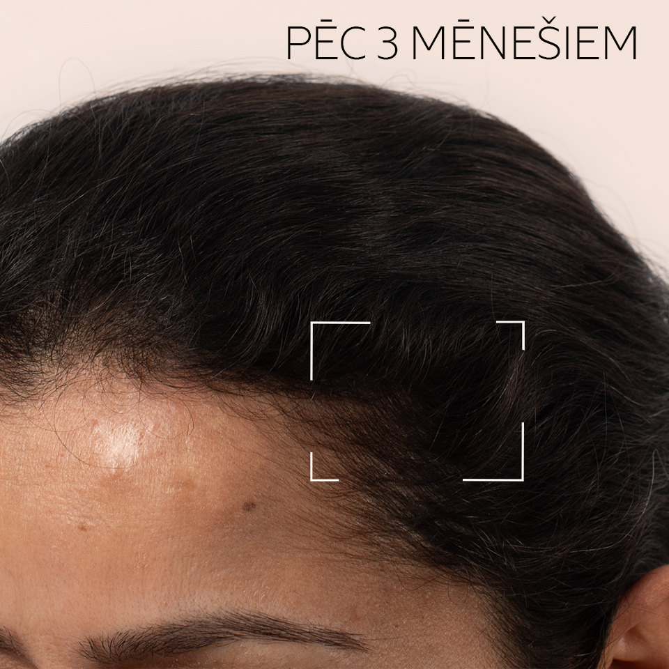 Serums matu augšanai