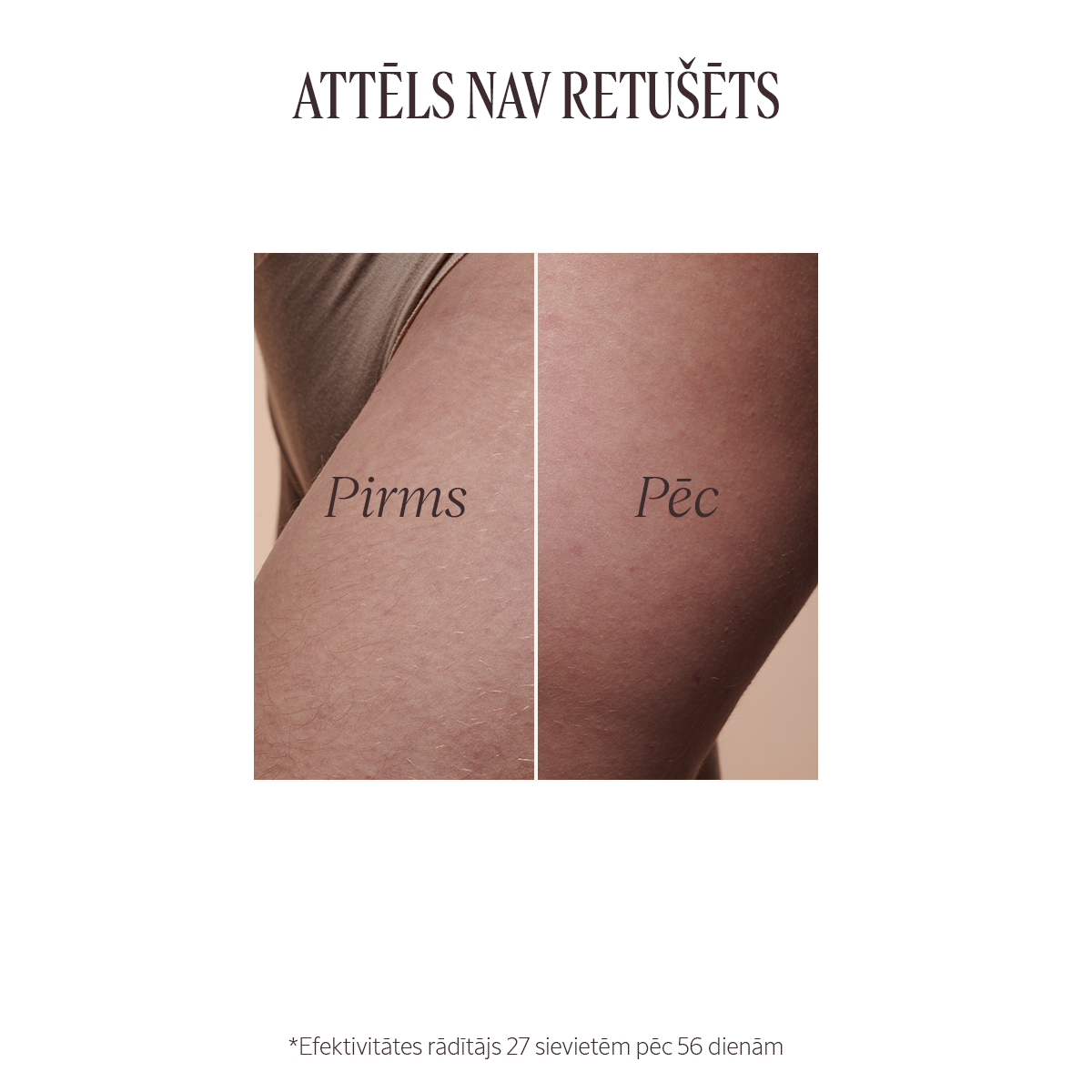 Mandeļu eļļa elastīgai ādai